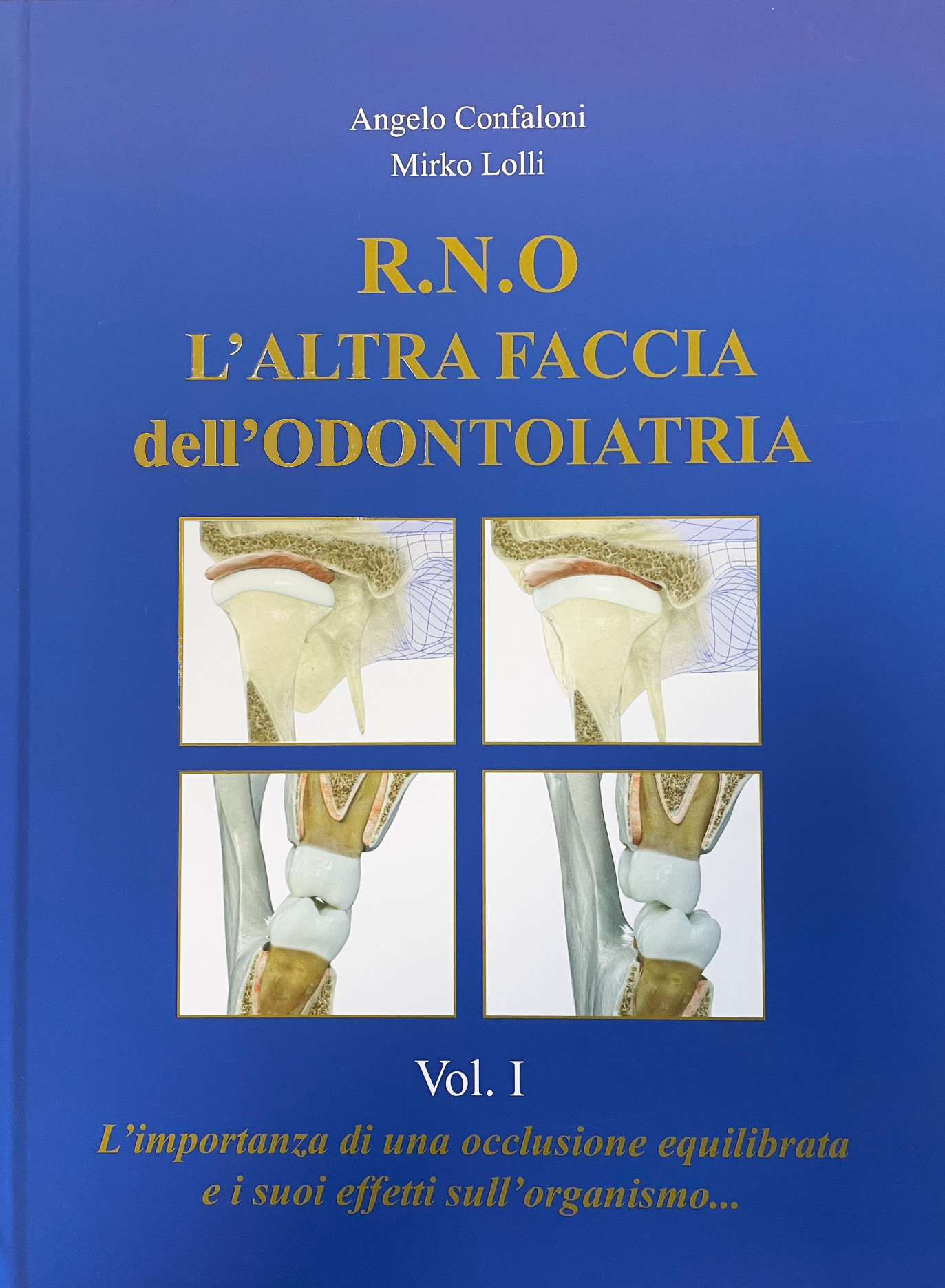 R.N.O L'ALTRA FACCIA DELL'ODONTOIATRIA Di Angelo Confaloni 