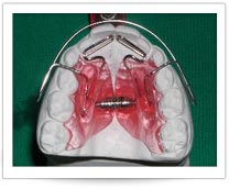 apparecchi ortodontici Planas