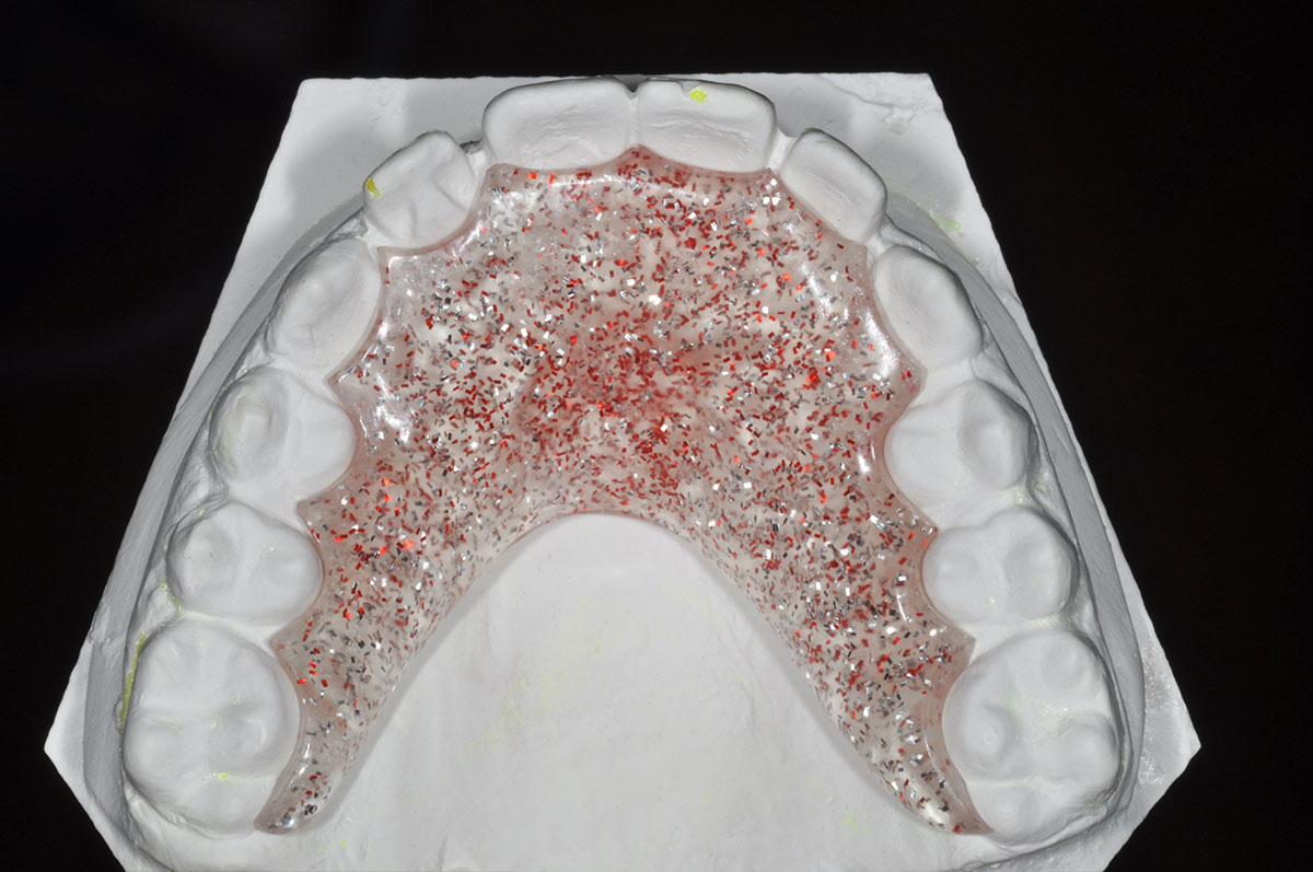 protesi  ortodontica